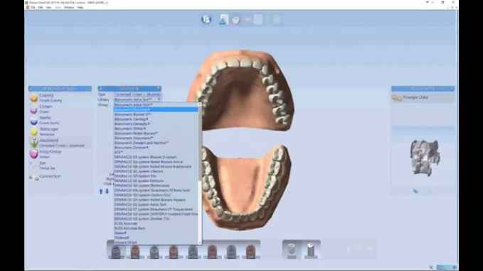 Delcam DentCAD 2015 Full indirme sayfası ekran görüntüsü
