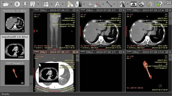 RadiAnt DICOM Viewer Full indirme sayfası ekran görüntüsü