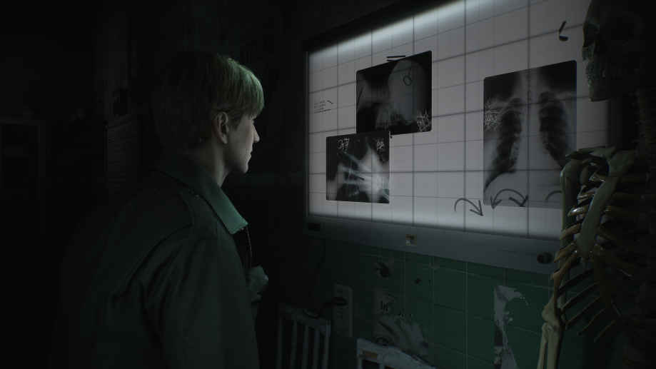 Silent Hill 2 Remake indirme sayfası ekran görüntüsü